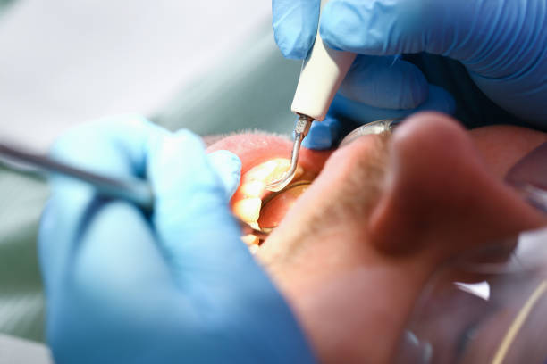 Best Dentist for Tooth Abscess  in Lincoln Heights, OH