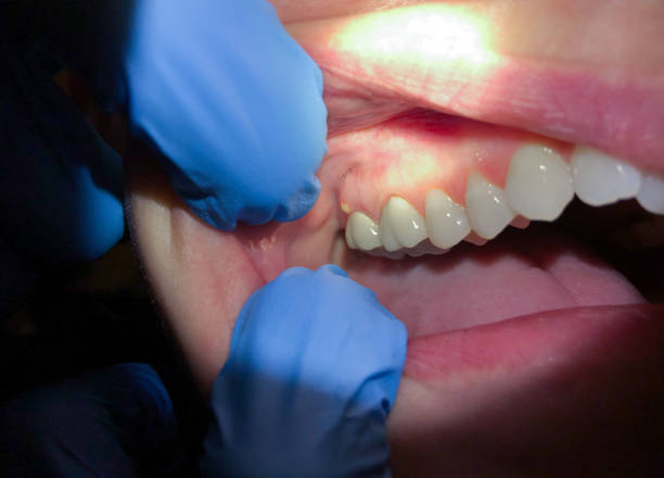 Best Emergency Gum Pain Relief  in Lincoln Heights, OH