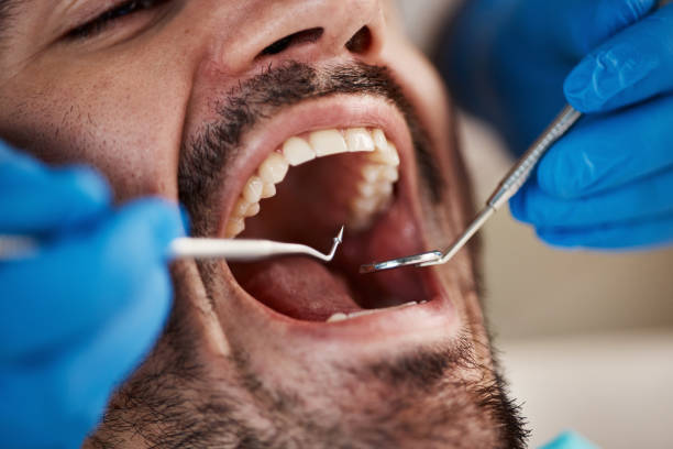 Best Cracked Tooth Emergency Dentist  in Lincoln Heights, OH